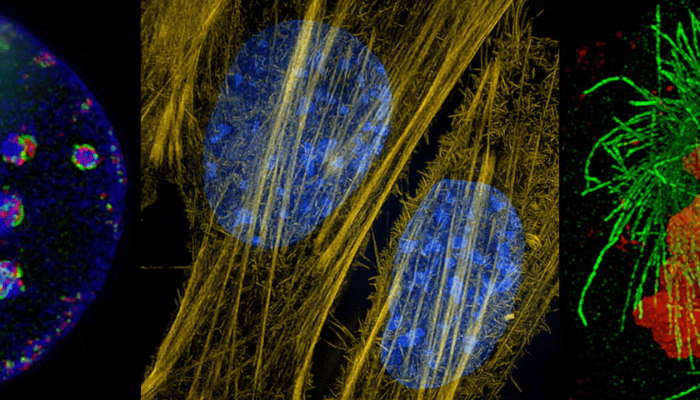 Super-Resolution Microscopes Showcase the Inner Lives of Cells