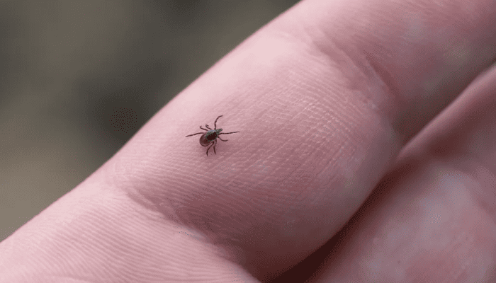 The First At-Home Test for Infected Ticks Could Improve Lyme Disease Diagnosis
