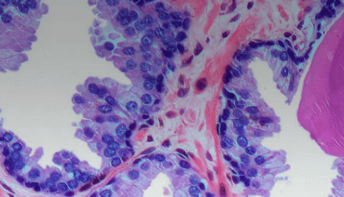 We Need a Better Way to Describe What Is Often Called Cancer